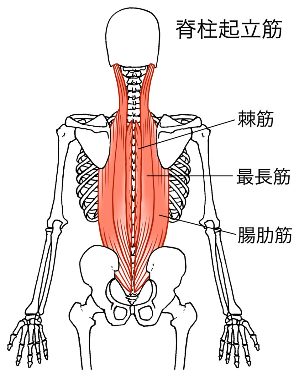 腰痛　原因　筋肉　脊柱起立筋