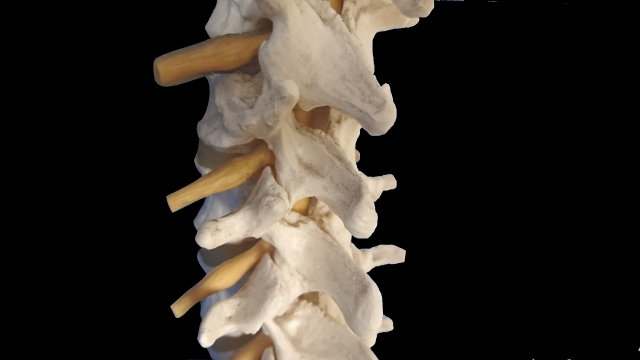 腰の痛み　椎間関節　場所