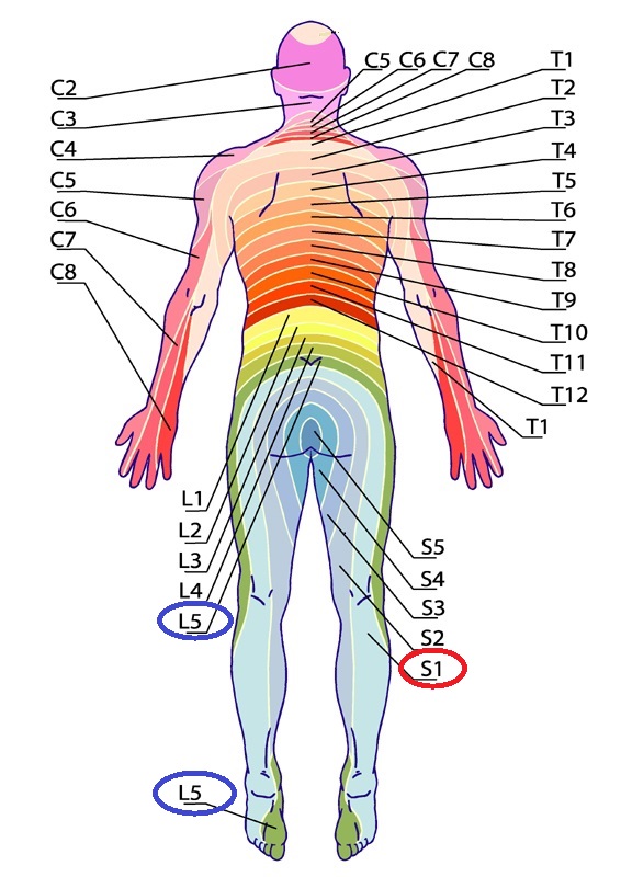 臀部痛　原因　神経性の痛み　デルマトーム　分かりやすい図