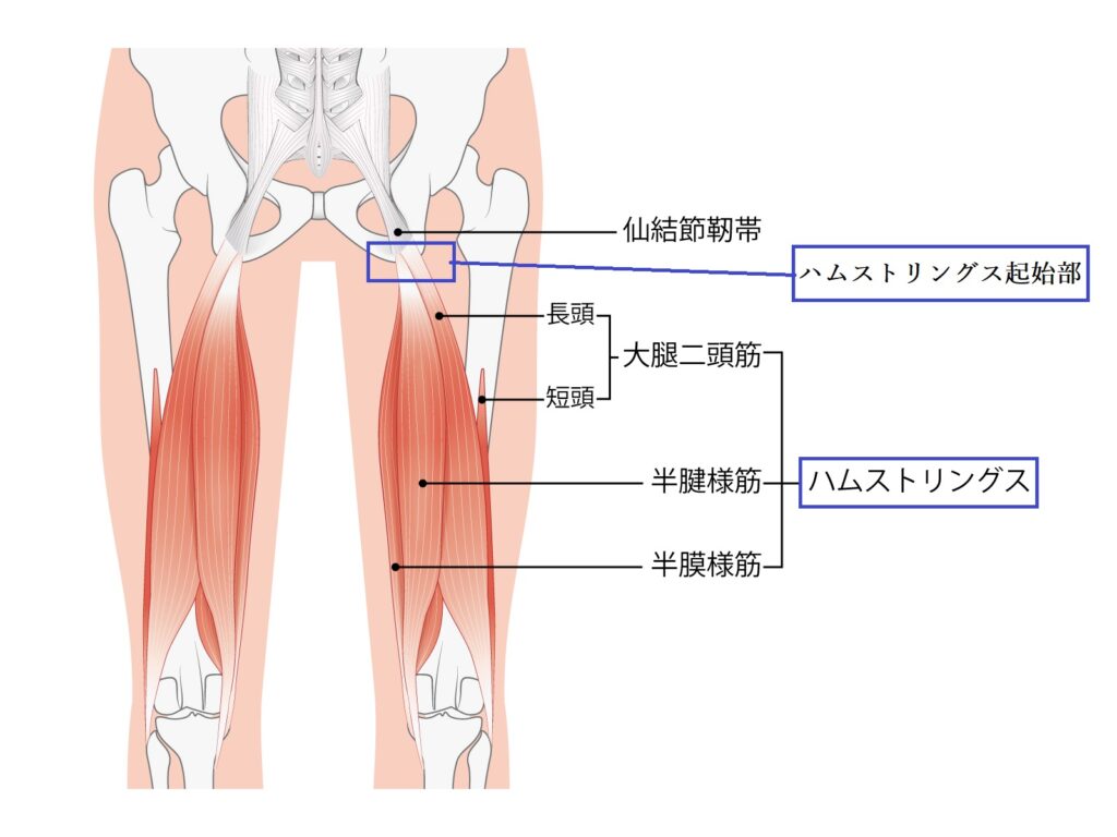 臀部痛　原因　ハムストリングス付着部　場所　分かりやすい図