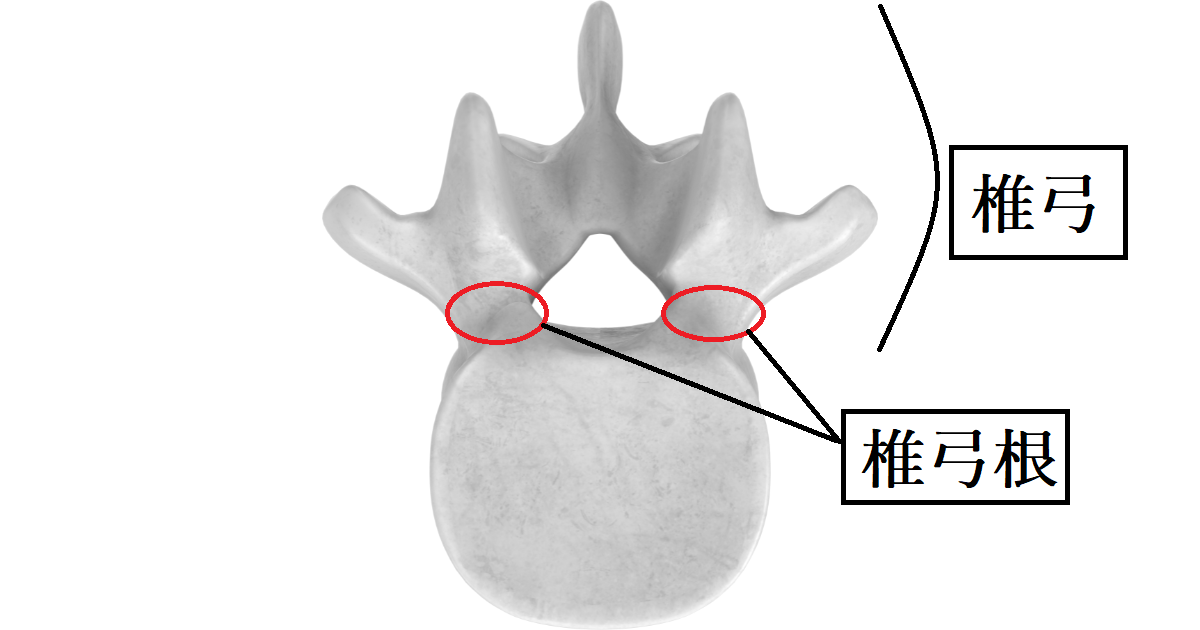 腰椎分離症　椎弓　椎弓根　説明　分かりやすく