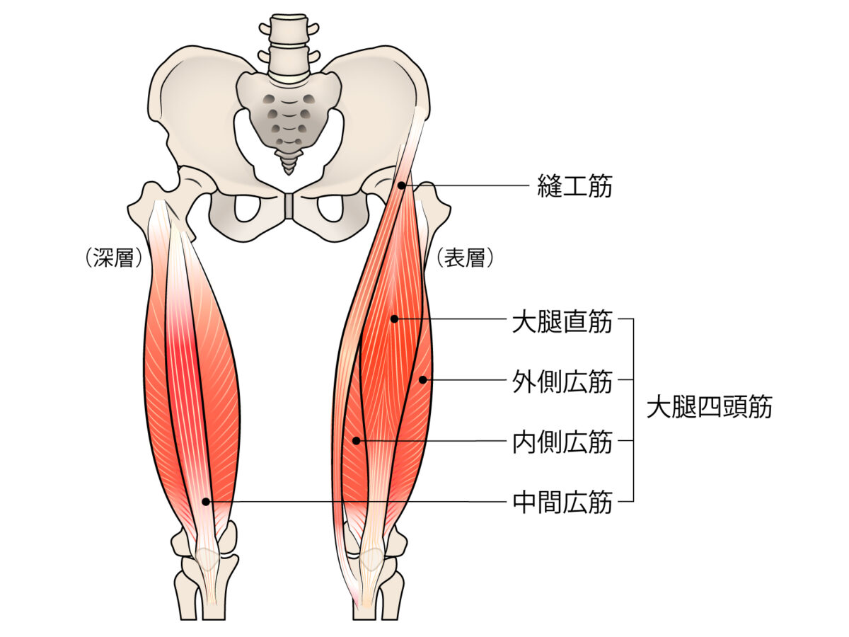 腰椎椎間板ヘルニア　L4神経根障害　大腿四頭筋　筋力低下
